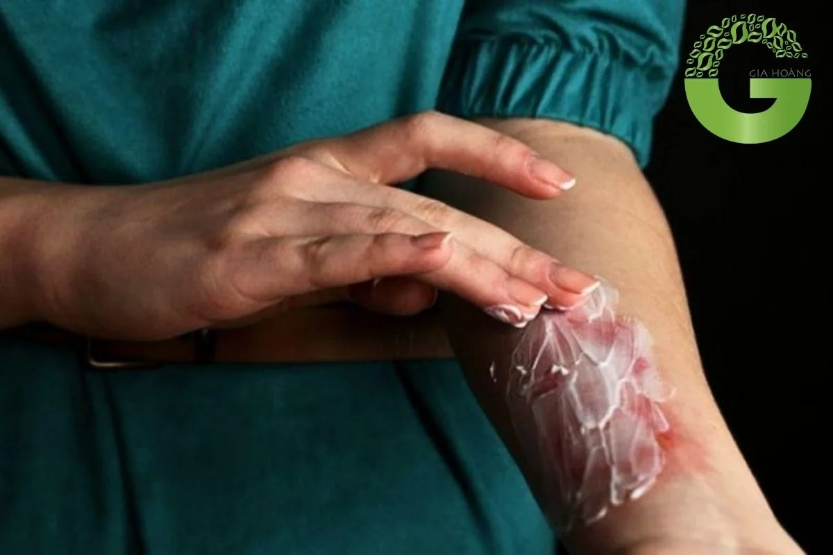 naoh có độc không