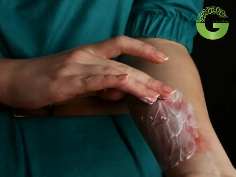 Ảnh hưởng của NaOH tới sức khỏe và môi trường