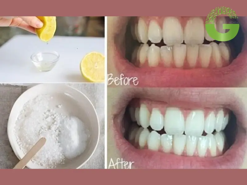 Công dụng của baking soda