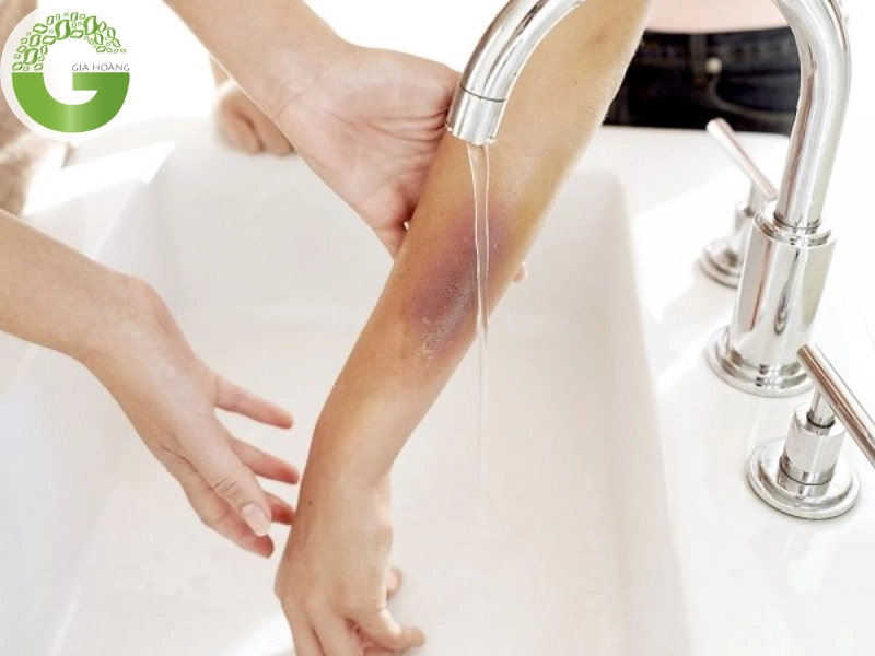 biện pháp bảo hộ khi sử dụng vô tôi