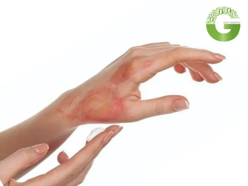 Sự nguy hiểm của xút lỏng NaOH